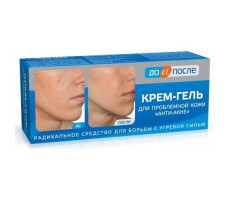 ДО И ПОСЛЕ КРЕМ-ГЕЛЬ АНТИ-АКНЕ Д/ПРОБЛ. КОЖИ 50МЛ. /ТВИНС ТЭК/