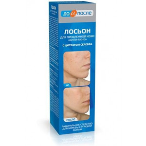 ДО И ПОСЛЕ ЛОСЬОН АНТИ-АКНЕ Д/ПРОБЛ. КОЖИ 200МЛ. /ТВИНС ТЭК/ ДО И ПОСЛЕ ЛОСЬОН АНТИ-АКНЕ Д/ПРОБЛ. КОЖИ 200МЛ. /ТВИНС ТЭК/